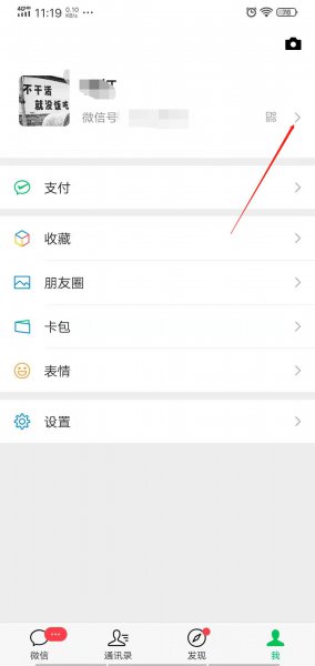 怎么设置微信拍一拍后面的字