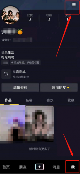 抖音抖一抖怎么关闭不了?