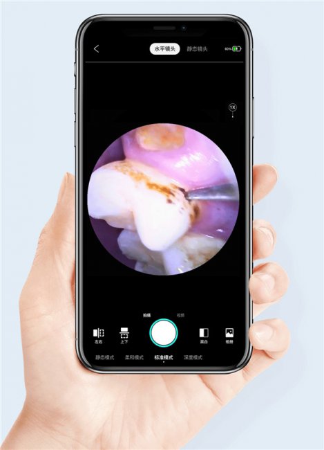 素诺可视洁牙仪T13 Pro评测