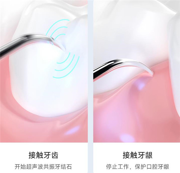 素诺可视洁牙仪T13 Pro评测