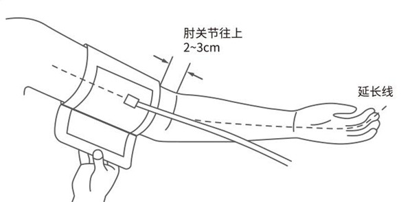 云康宝智能血压计评测