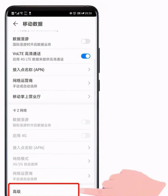 手机网络怎么设置网速快