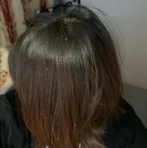 男士去屑洗发水哪个牌子最好 最好的去屑洗发水排行榜