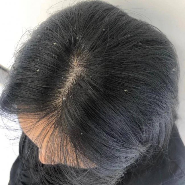 男士去屑洗发水哪个牌子最好