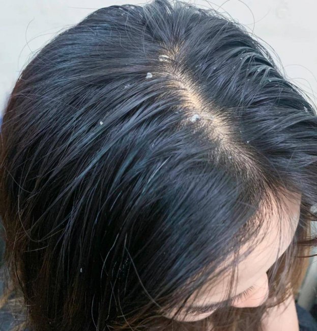 男士去屑洗发水哪个牌子最好