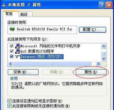电脑本地连接设置方法是什么