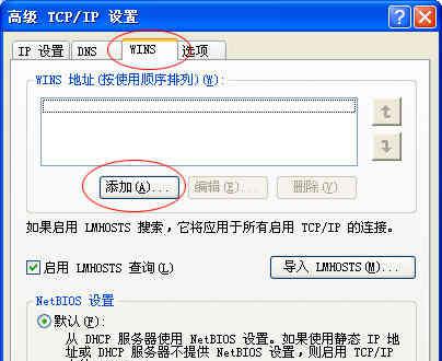 电脑本地连接设置方法是什么