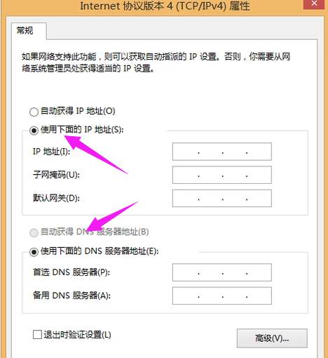 受限制或无连接解决方法是什么