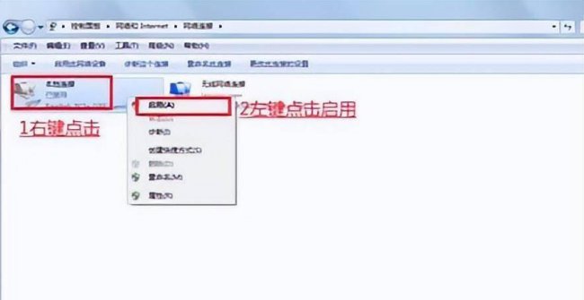 本地连接没有了怎么恢复正常