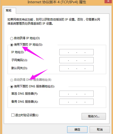 电脑本地连接受限制或无连接怎么办