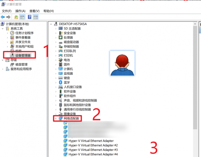 有网但是win10电脑连不上网怎么办