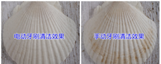 飞利浦电动牙刷质保期多久