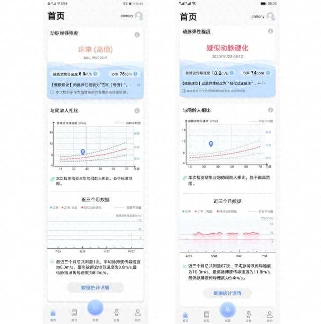 华为gt2proecg手表功能详解