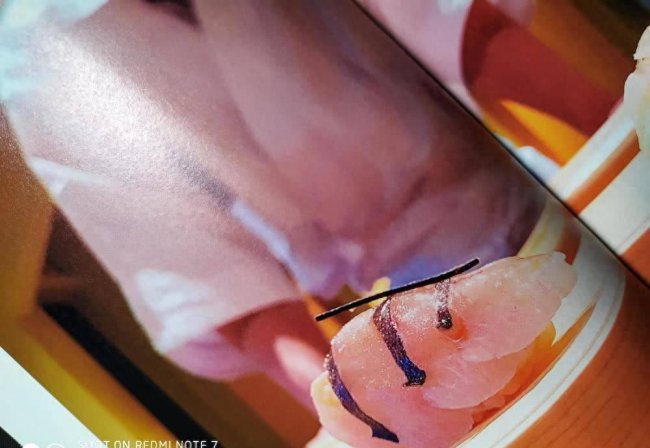 小米note7手机参数配置